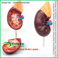 SELL 12434 Enlarge Model Kidney ,2 Part , Anatomy Urinary Models